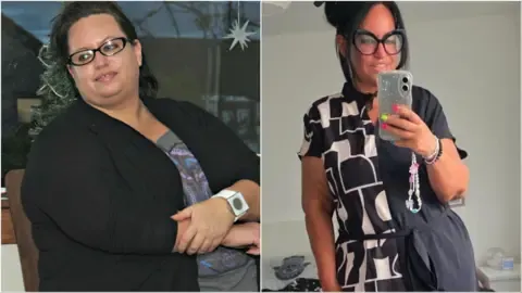 Many Dropped Weight Using Jabs – Followed By the Sagging Skin